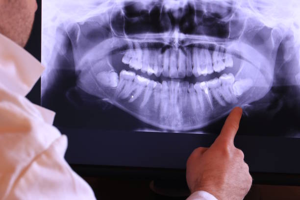 Best Knocked-Out Tooth Emergency  in Oneonta, AL